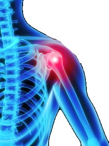ClinicaJDFranca_Ortopedia_Cirurgia_do_Ombro